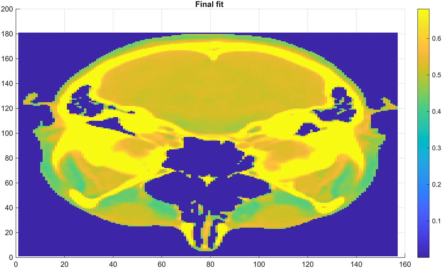 The proton Computed Tomography (pCT) of an axial brain slice. The slice consists of 1mm cubes known as voxels. The color bar reflects the Relative Stopping Power (RSP) of each voxel as would be “seen” by 250MeV protons. The image was created using simulated 250 MeV protons (Geant4). The conventional CT data was used to “seed” the algorithm. Random noise up to 8% of the conventional CT to RSP via Hounsfield, conversion was applied to each voxel to create the true pCT slice. The algorithm used the absorbed energy and entrance/exit points to compute the true slice.